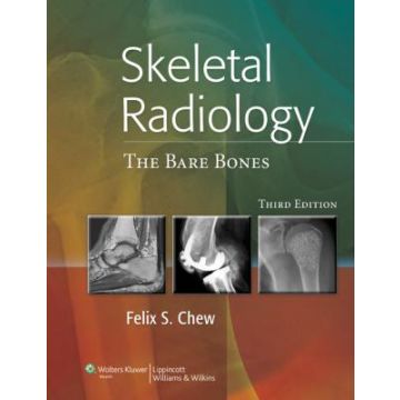 Skeletal Radiology: The Bare Bones, 3ed.  Chew Felix S.  LIPPINCOTT Williams and Wilkins  9781608317066