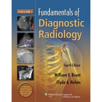 Fundamentals of Diagnostic Radiology - 4 Volume Set, 4ed.  Brant William E.; Helms Clyde  LIPPINCOTT Williams and Wilkins  9781608319121