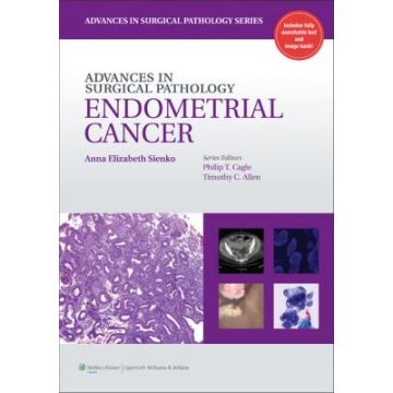 Advances in Surgical Pathology: Endometrial Carcinoma  Sienko Anna  LIPPINCOTT Williams and Wilkins  9781609131784