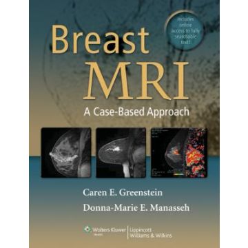 Breast MRI. A Case-based approach  Greenstein Caren; Manasseh Donna Marie E.  LIPPINCOTT Williams and Wilkins  9781609132361