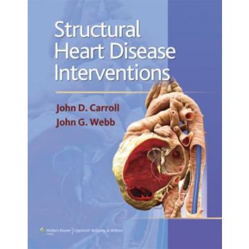 Structural Heart Disease Interventions  Carroll John D.; Webb John G.  LIPPINCOTT Williams and Wilkins  9781609137106