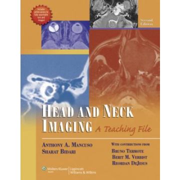 Head and Neck Imaging, 2ed.  Mancuso Anthony A.; Bidari Sharat; Termote Bruno; Verbist Berit M.; DeJesus Reordan  LIPPINCOTT Williams and Wilkins  9781609137120