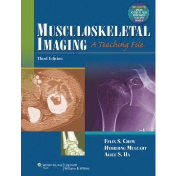 Musculoskeletal Imaging, 3ed.  Chew Felix  LIPPINCOTT Williams and Wilkins  9781609137939