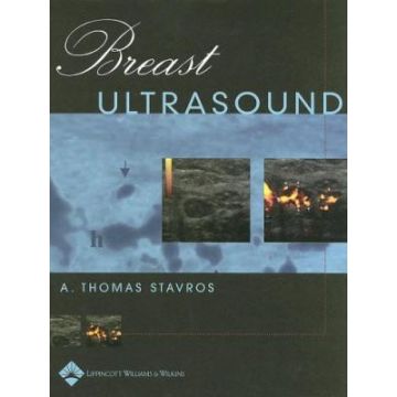 Breast Ultrasound, 2ed.  Stavros A. Thomas; Rapp Cynthia L.; Parker Steve H.  LIPPINCOTT Williams and Wilkins  9781609138110