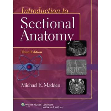 Introduction to Sectional Anatomy, 3ed.  Madden Michael  LIPPINCOTT Williams and Wilkins  9781609139612