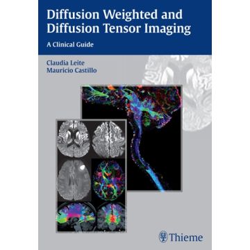 Diffusion Weighted and Diffusion Tensor Imaging. A Clinical Guide  Leite Claudia; Castillo Mauricio  Thieme  9781626230217