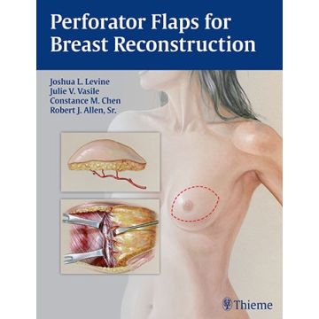 Perforator Flaps for Breast Reconstruction  Levine Joshua L.; Vasile Julie V.; Chen Connie; Allen Robert J.  Thieme Medical Publishers  9781626230941