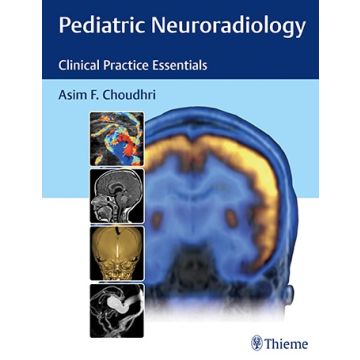 Pediatric Neuroradiology - The Essentials    [Choudhri - Thieme]