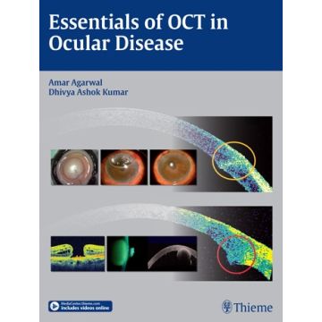 Essentials of OCT in Ocular Disease  Agarwal Amar; Steinert Roger F.; Kumar Dhivya Ashok  Thieme Medical Publishers  9781626230989