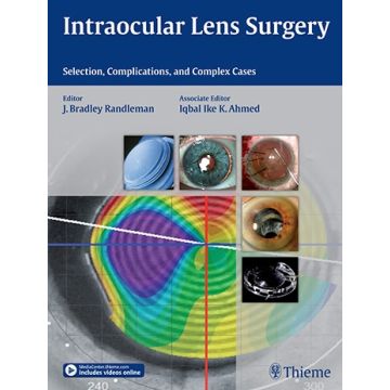 Intraocular Lens Surgery  Randleman Bradley; Ahmed Iqbal Ike K.  Thieme Medical Publishers  9781626231146