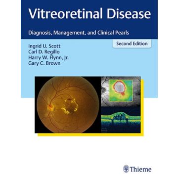 Vitreoretinal Disease - Diagnosis, Management, and Clinical Pearls     [Scott - Thieme]