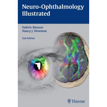 Neuro-Ophthalmology Illustrated, 2/ed.  Biousse Valerie; Newman Nancy J.  Thieme Medical Publishers  9781626231498