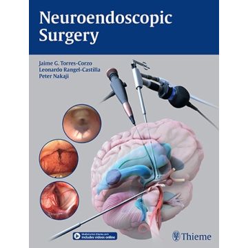 Neuroendoscopic Surgery  Torres-Corzo Jaime; Rangel-Castilla Leonardo; Nakaji Peter  Thieme Medical Publishers  9781626231610