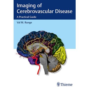 Imaging of Cerebrovascular Disease. A Practical Guide  Runge Val M.  Thieme Medical Publishers  9781626232488