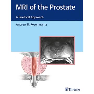 MRI of the Prostate - A Practical Approach    [Rosenkrantz - Thieme]