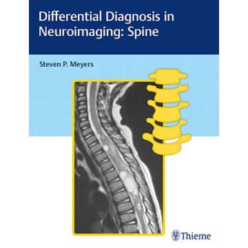 Differential Diagnosis in Neuroimaging - Spine     [Meyers - Thieme]
