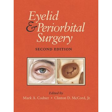 Eyelid and Periorbital Surgery, Second Edition    [Codner - Thieme]
