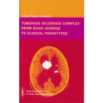 Tuberous Sclerosis Complex : From Basic Science to Clinical Phenotypes  Curatolo Paolo  Wiley - Blackwell  9781898683391