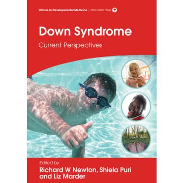 Down Syndrome: Current Perspectives  Newton Richard W.; Marder Liz; Puri Shiela C.  Wiley-Blackwell  9781909962477