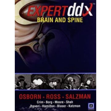 EXPERTddx: Brain and Spine  AA.VV.  LIPPINCOTT Williams and Wilkins  9781931884020