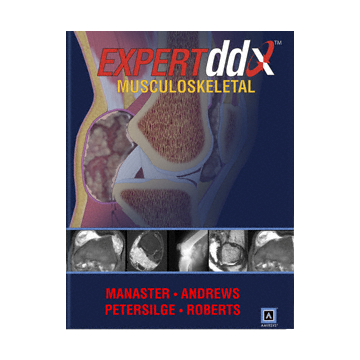 EXPERTddx: Musculoskeletal  Manaster B. J.; Roberts Catherine C.; Andrews  Carol L.; Petersilge Cheryl A.  LIPPINCOTT Williams and Wilkins  9781931884037