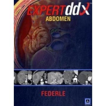 EXPERTddx: Abdomen  Federle Michael P.  LIPPINCOTT Williams and Wilkins  9781931884099