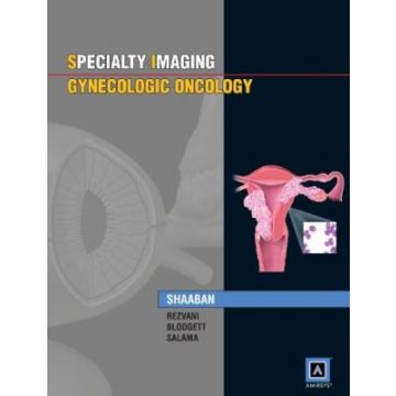 Specialty Imaging: Gynecologic Oncology  Shaaban Akram M.; Rezvani Maryam; Blodgett Todd M.  LIPPINCOTT Williams and Wilkins  9781931884228