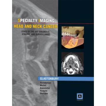 Specialty Imaging: Head & Neck Cancer  Glastonbury Christine M.; Harnsberger H. Ric; Michel Michelle A.  LIPPINCOTT Williams and Wilkins  9781931884259