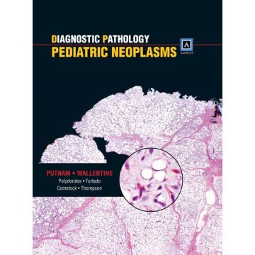 Diagnostic Pathology: Pediatric Neoplasms  Putnam Angelica R.; Wallentine Jeremy C.  LIPPINCOTT Williams and Wilkins  9781931884549