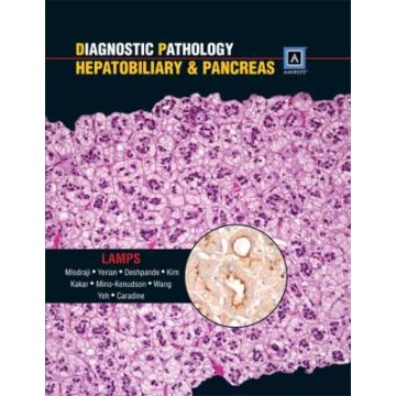 Diagnostic Pathology: Hepatobiliary & Pancreas  Lamps Laura  LIPPINCOTT Williams and Wilkins  9781931884563