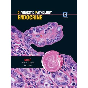 Diagnostic Pathology: Endocrine  Nose Vania; Asa Sylvia L.; Erickson Lori A.; Lopes Beatriz S.; Tischler Arthur S.  LIPPINCOTT Williams and Wilkins  9781931884594