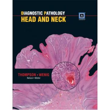 Diagnostic Pathology: Head and Neck  Thompson Lester D.R.; Wenig Bruce M.  LIPPINCOTT Williams and Wilkins  9781931884617