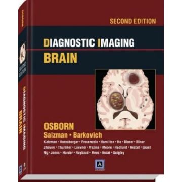 Diagnostic Imaging: Brain, 2ed.  Osborn Anne G.; Salzman Karen L.; Barkovich A. James  LIPPINCOTT Williams and Wilkins  9781931884723