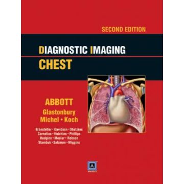 Diagnostic Imaging: Chest, 2ed.  Rosado-de-Christenson Melissa L.; Abbott Gerald F.  LIPPINCOTT Williams and Wilkins  9781931884754