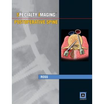 Specialty Imaging: Postoperative Spine  Ross Jeffrey S.  LIPPINCOTT Williams and Wilkins  9781931884891