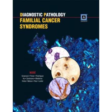 Diagnostic Pathology: Familial Cancer Syndromes  Nose Vania; Greenson Joel K.; Paner Gladell P.  LIPPINCOTT Williams and Wilkins  9781931884969