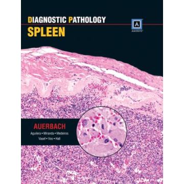 Diagnostic Pathology: Spleen - Auerbach Aaron - Lippincott Williams and Wilkins - 9781931884983