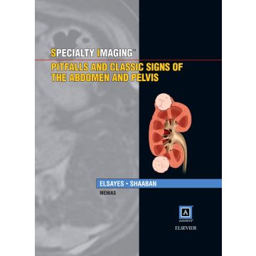 Specialty Imaging: Pitfalls and Classic Signs of the Abdomen and Pelvis    [Elsayes - Elsevier Science]