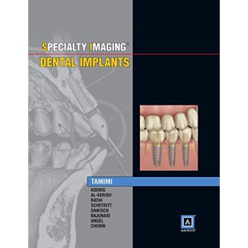 Specialty Imaging: Dental Implants    [Tamimi - Elsevier Science]