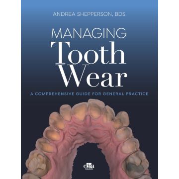 Managing tooth Wear. A comprehensive guide for general practice  [Shepperson Andrea - Elsevier Masson]