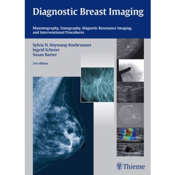Diagnostic Breast Imaging. Mammography, Sonography, Magnetic Resonance Imaging, and Interventional Procedures  Heywang-Koebrunner Sylvia H.; Schreer Ingrid; Barter Susan  Thieme Medical Publishers  9783131028938