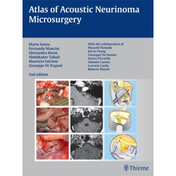Atlas of Acoustic Neurinoma Microsurgery  Sanna Mario; Mancini Fernando; Russo Alessandra; Taibah Abdelkader; Falcioni Maurizio; Di Trapani Giuseppe  Thieme Medical Publishers  9783131102829