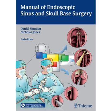 Manual of Endoscopic Sinus and Skull Base Surgery  Simmen Daniel; Jones Nick S.  Thieme Medical Publishers  9783131309723