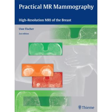 Practical MR Mammography. High-Resolution MRI of the Breast, 2/ed.  Fischer Uwe  Thieme Medical Publishers  9783131320322
