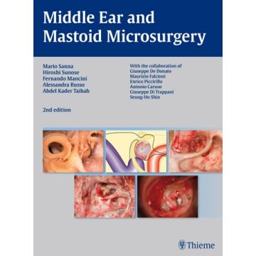 Middle Ear and Mastoid Microsurgery  Sanna Mario; Sunose Hiroshi; Mancini Fernando; Russo Alessandra; Taibah Abdelkader  Thieme Medical Publishers  9783131320926