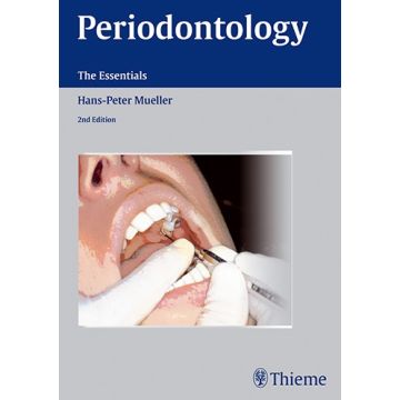 Periodontology. The Essentials  Mueller Hans-Peter  Thieme Medical Publishers  9783131383723
