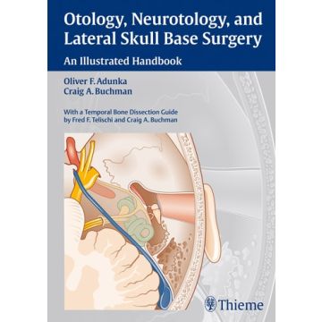 Otology, Neurotology, and Lateral Skull Base Surgery. An Illustrated Handbook  Adunka Oliver Franz; Buchman Craig A.  Thieme Medical Publishers  9783131450210