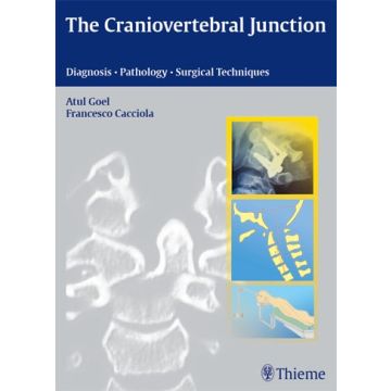 The Craniovertebral Junction. Diagnosis - Pathology - Surgical Techniques  Goel Atul; Cacciola Francesco  Thieme Medical Publishers  9783131455819