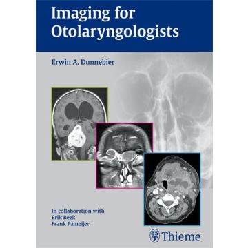 Imaging for Otolaryngologists  Dunnebier Erwin A.  Thieme Medical Publishers  9783131463319
