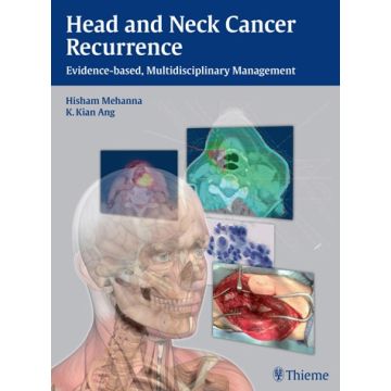 Head and Neck Cancer Recurrence. Evidence-based, Multidisciplinary Management  Mehanna Hisham M.; Ang K. Kian  Thieme Medical Publishers  9783131473912